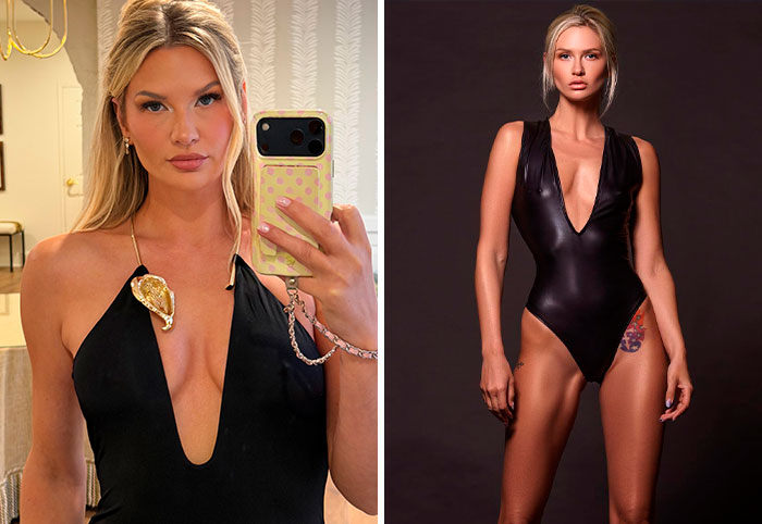 Molly O'Connell’s Not-So-Secret Surgery Saga