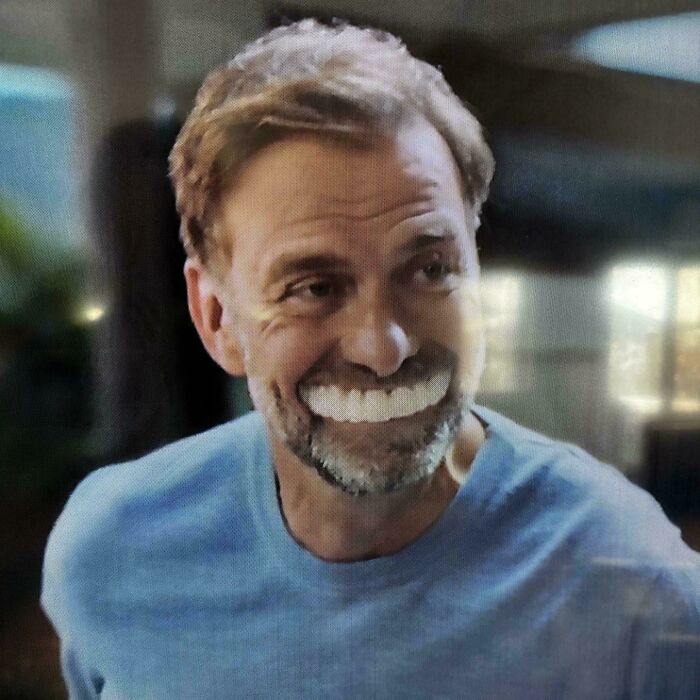 Trivago Teeth—They Keep Getting Bigger?