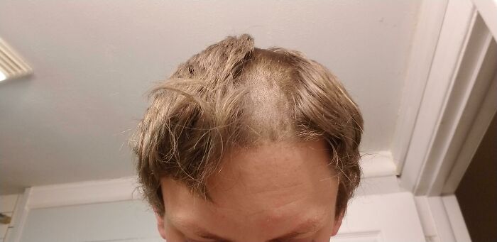 Fixed My Hair Trimmer But Forgot The Depth Guard. Haircut Disaster Incoming!