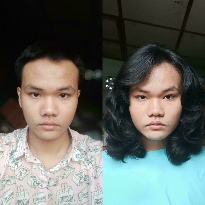 One Year of Hair Growth, Zero Regrets