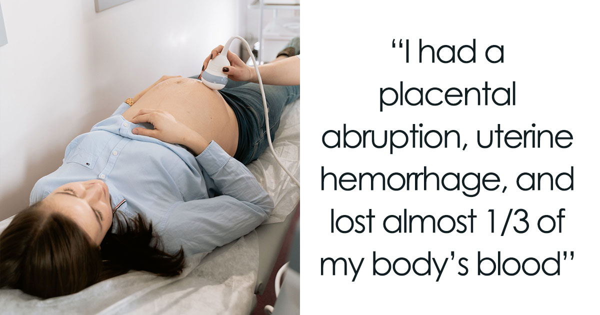 Crazy Things Moms Went Through That No One Warned Them About