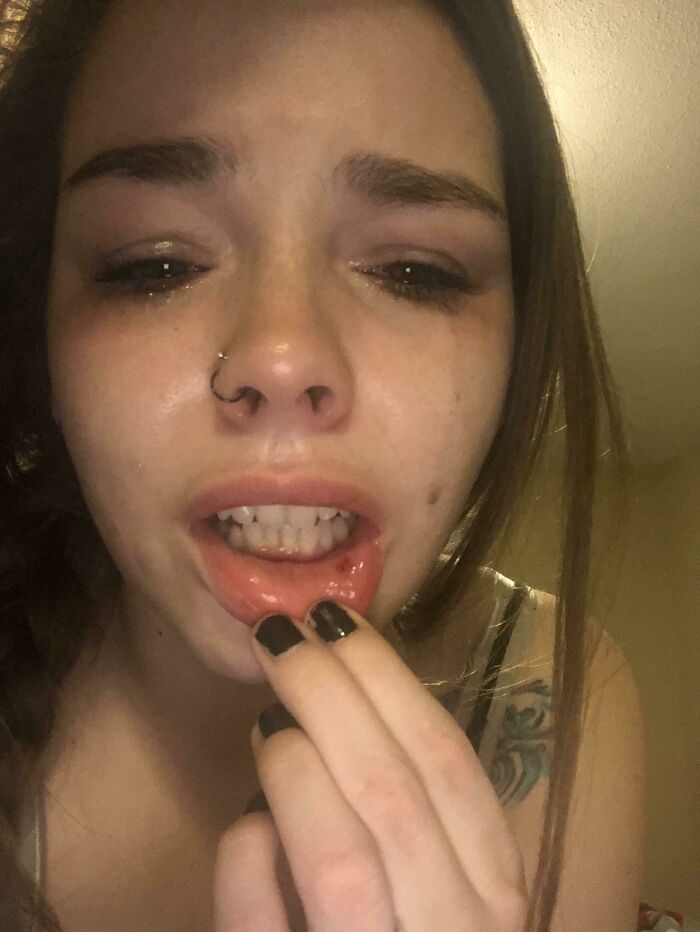 Toddler Throws iPad at Sleeping Parent, Pierces Lip