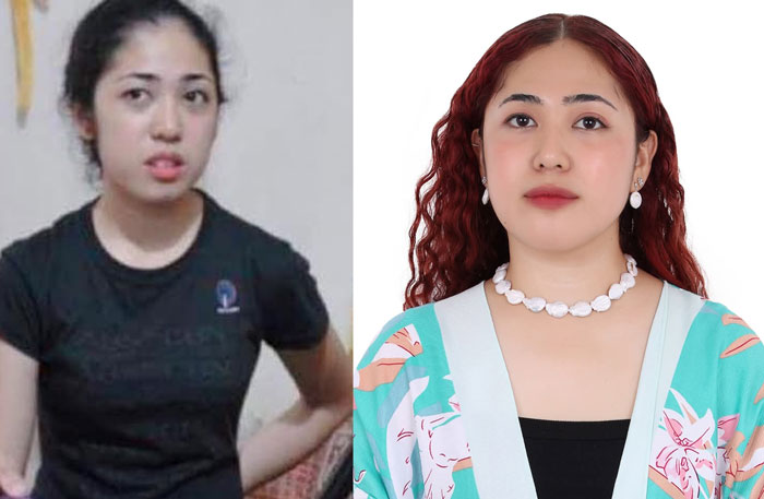 The Glow-Up Showdown: 69 People Who Totally Nailed Their Evolution