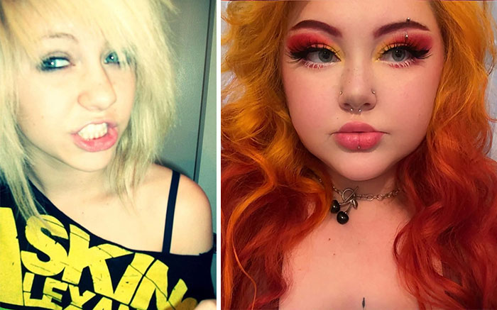 The Glow-Up Showdown: 69 People Who Totally Nailed Their Evolution