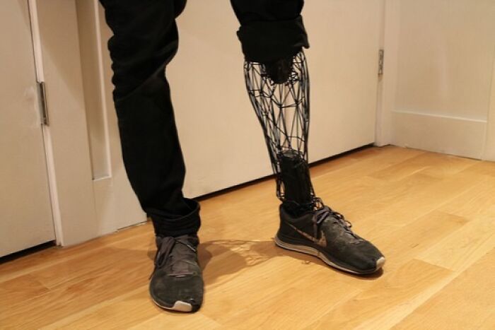 Meet the Wireframe Prosthetic Leg That’s Half Tech, All Awesome