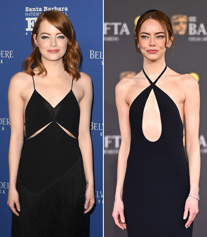 Emma Stone’s Sleek but Worrying Look