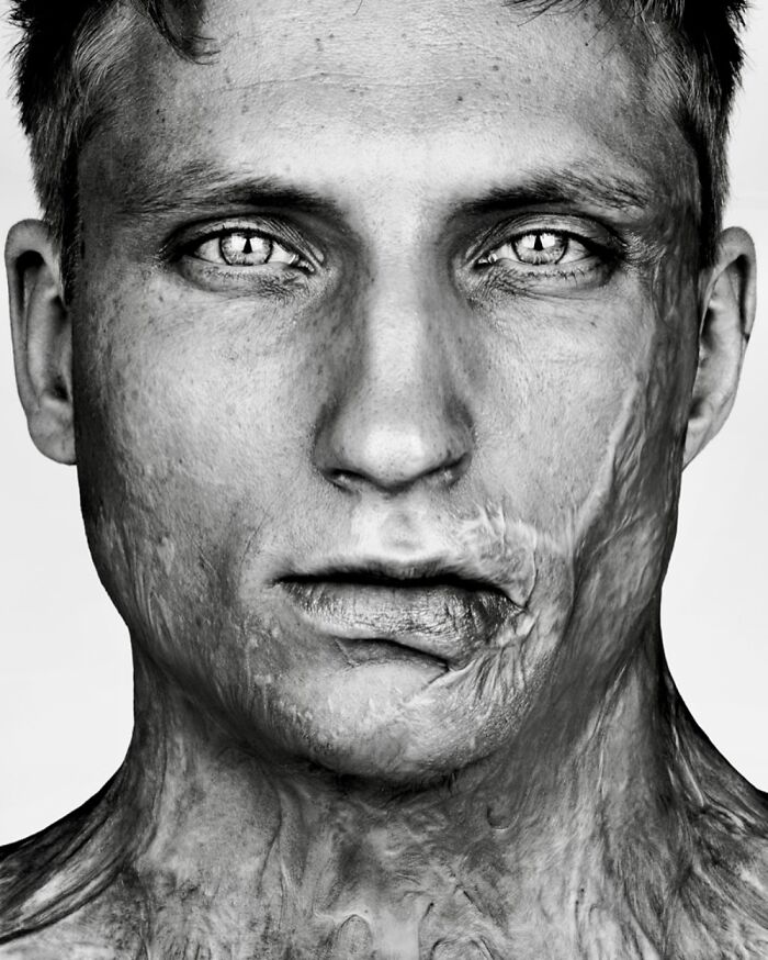 Axel Schylström: Scarred and Stunning