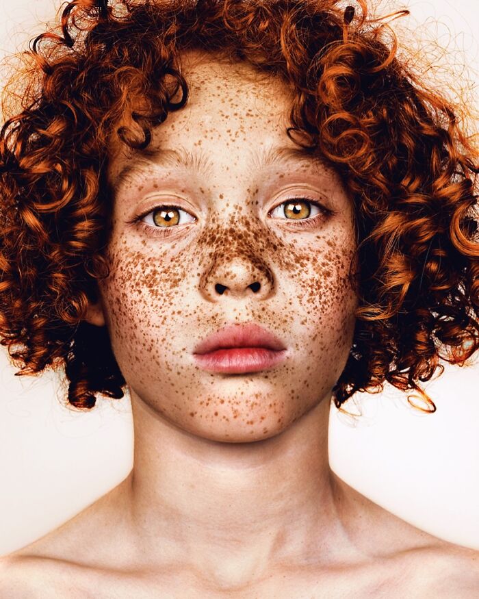 Josh: Mr. Freckles