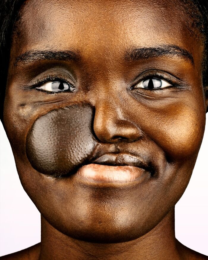 Crystal Mitchell: Living Proof in Scars
