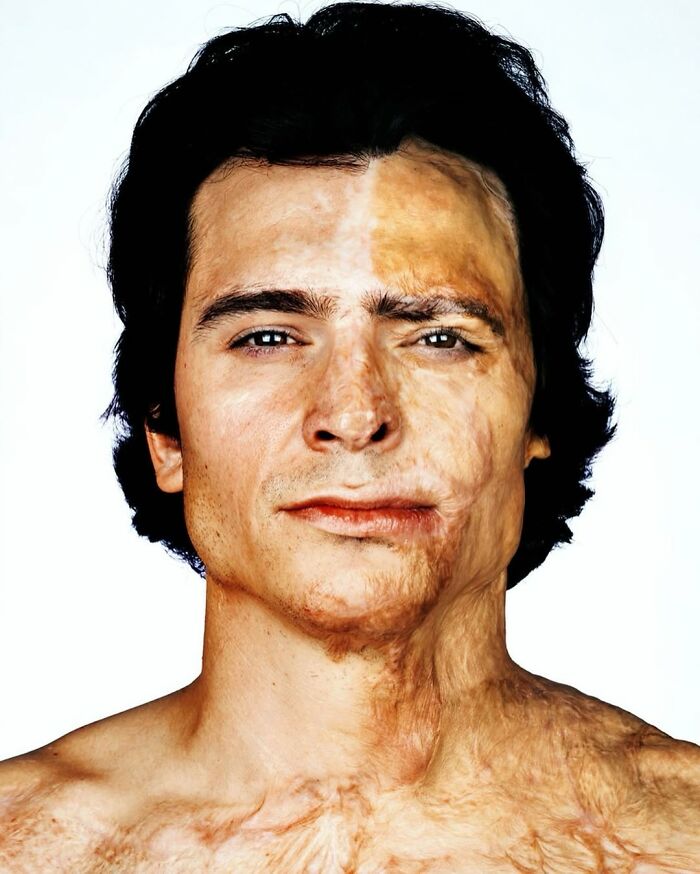 Beau Zanca: Scar Storyteller