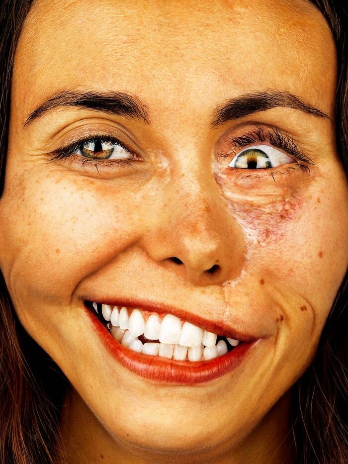 Isabella Welch: Scars with Style
