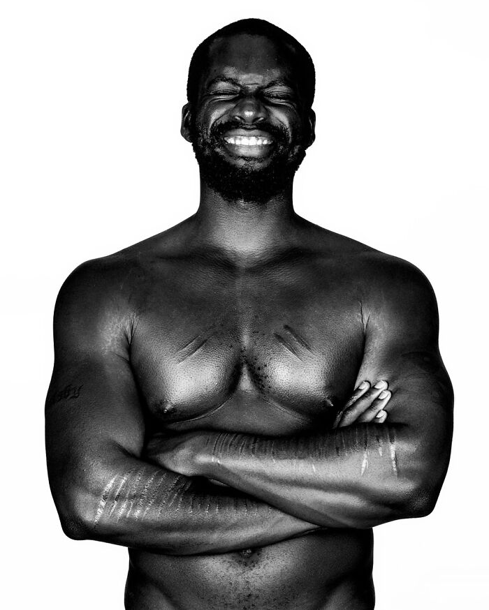 Derek Owusu: Scars Speak Louder