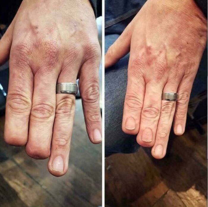 When Tattoos Do More Than Ink – They Heal