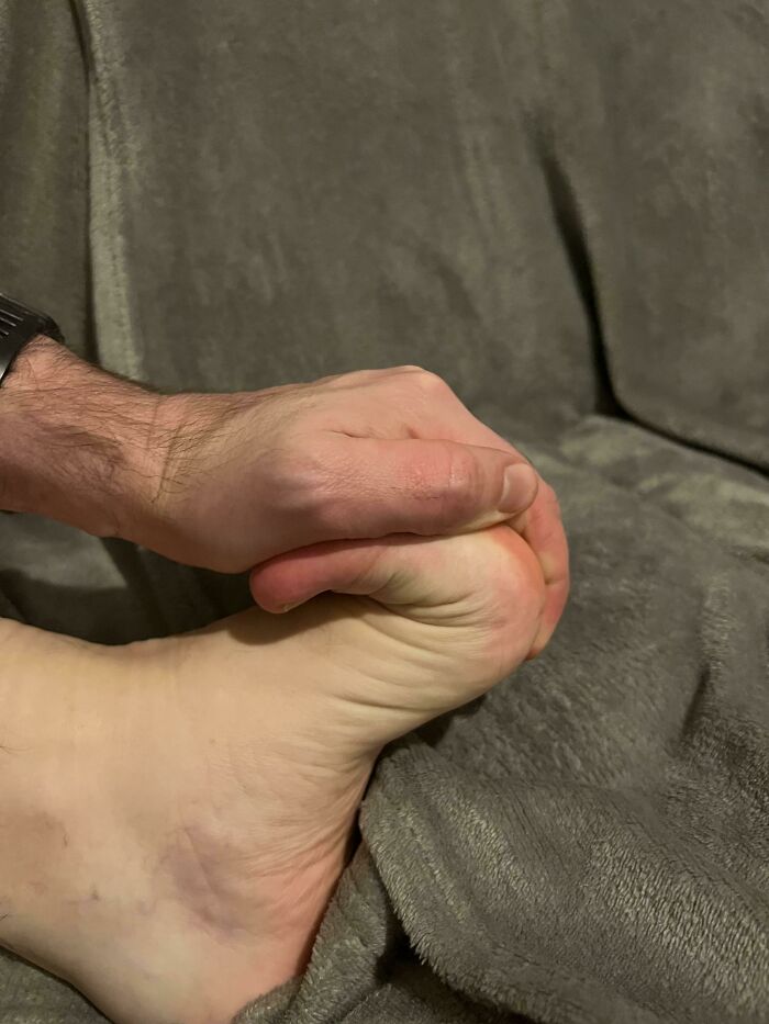I Can Bend My Toes All The Way Back To My Foot
