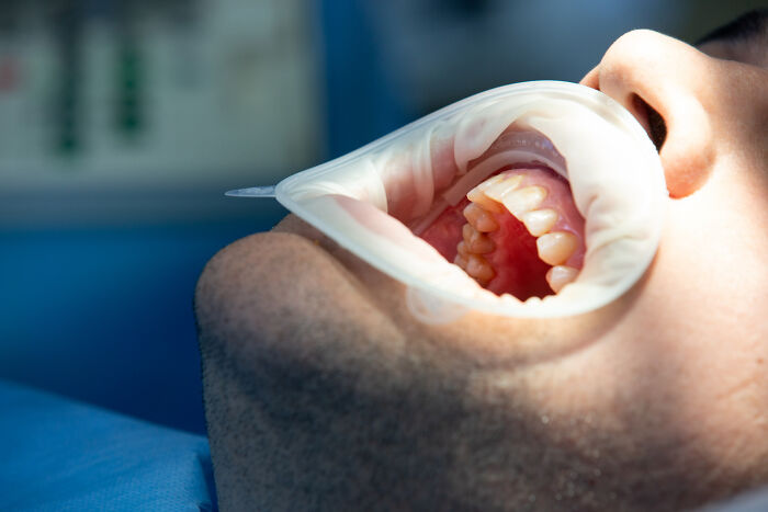 Wait Till You Hear About These Medical Procedures That Totally Surprised Everyone