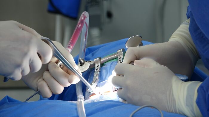 Wait Till You Hear About These Medical Procedures That Totally Surprised Everyone