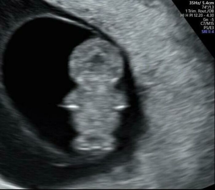 My Future Son Might Just Be a South Park Character in Disguise