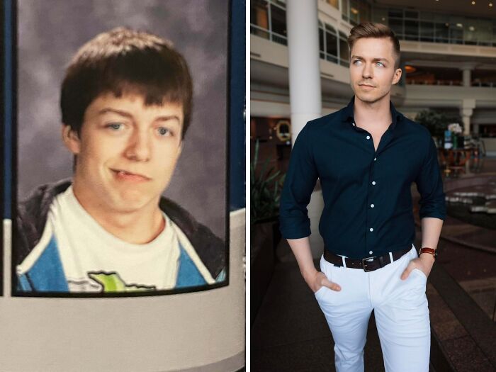 16 to 26: Braces, Fixes, and Glow-Up Magic