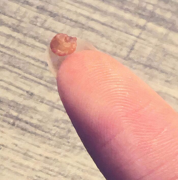 What’s This Hard Orange Stuff I Keep Finding in My Food?