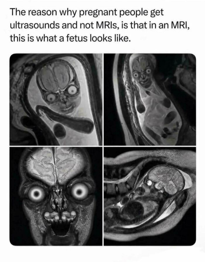 Wait, These Weird Earth Things Actually Exist?!