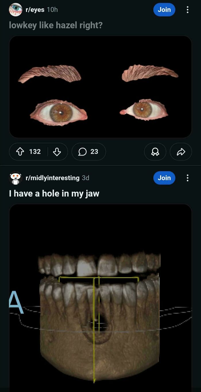 Mildly Terrifying? You Betcha.