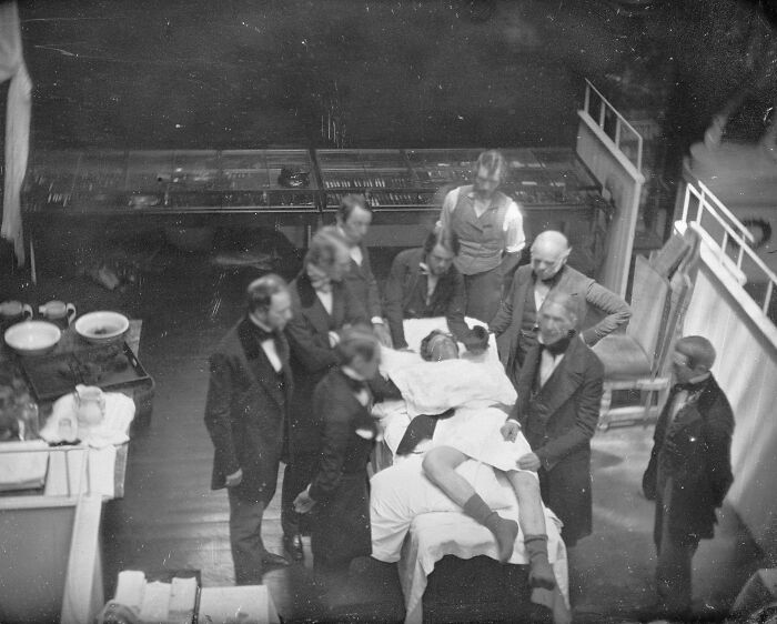 Early Ether Anesthesia Surgery, Boston 1847 — Medical Breakthrough