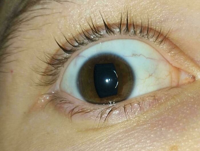 My Pupils Are Rectangular – Eye Spy Something Weird