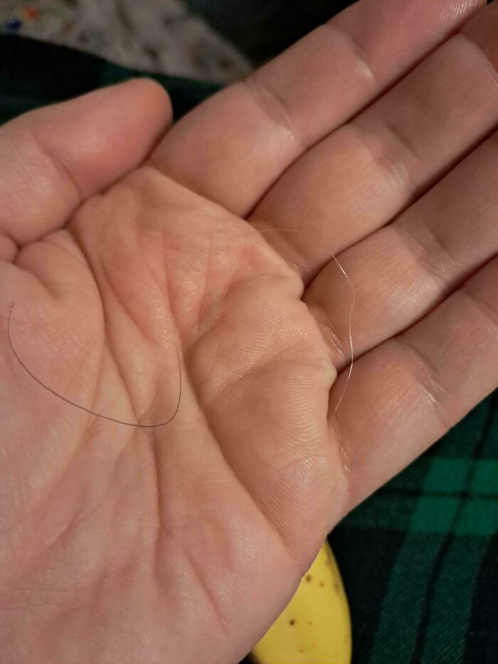 Grey Hair Turning Back to Brown – Hair for the Win!