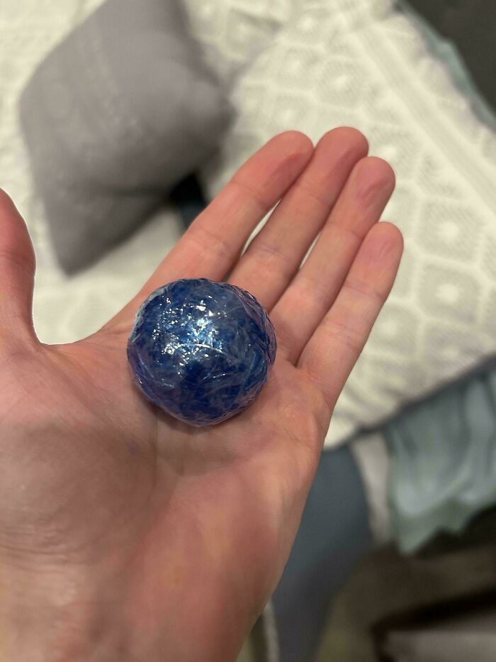 My Cousin’s Contact Lens Left a Perfect Little Ball – So Cute!