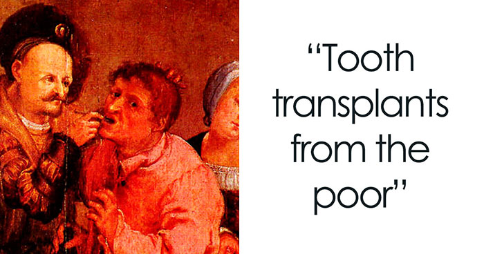 Wait, They Actually Tried These 18 Weird Medical Treatments?!