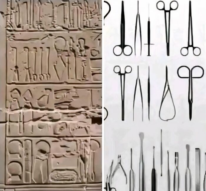 Surgical Tools From 3000 Years Ago That Look Shockingly Modern