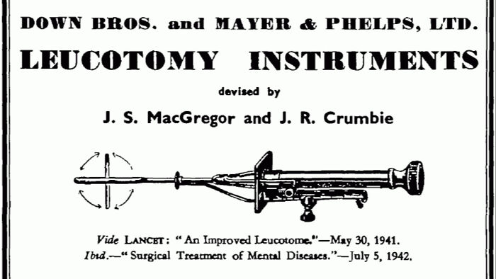 Lobotomies: The Brain Surgery That Made Everything Worse