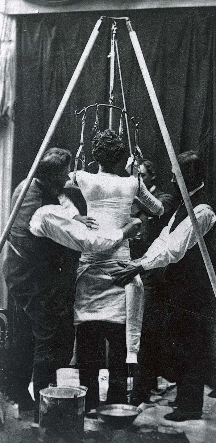 Getting Treated for Scoliosis in 1877 Looks Brutal