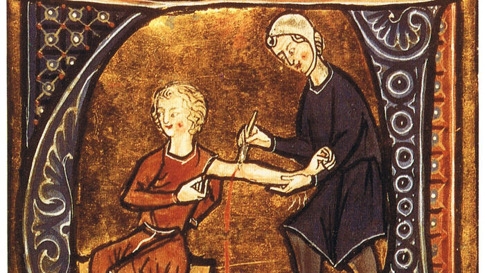 Bloodletting: When Losing Blood Was the Cure