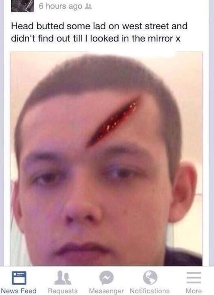 Oops! The 45 Cringe Pics That’ll Make You Laugh and Hide Your Face
