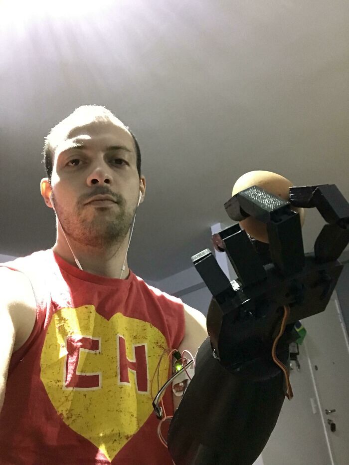Born Without An Arm, So I Built Myself A 3D Printed Electronic One (Egg-Handling Level: Expert)
