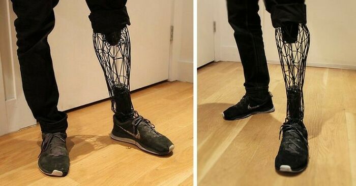 Exo-Prosthetic Leg From Titanium? Yes Please! Designed By William Root
