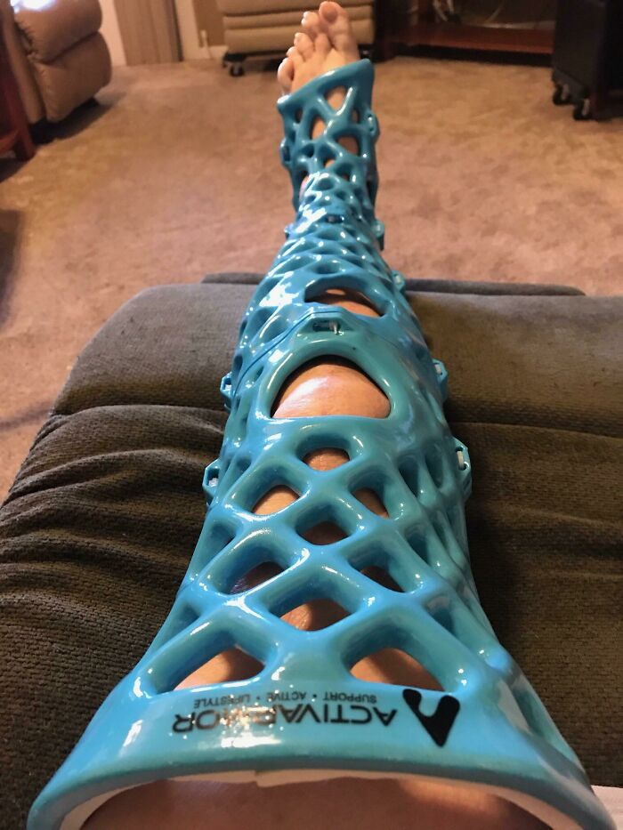 My Mom’s 3D Printed Cast Lets Her Shower—No Drama!