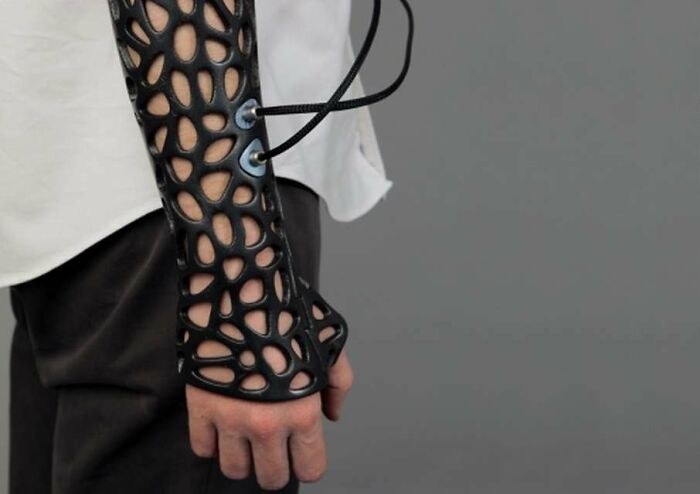 This 3D Printed Cast Heals Bones 40% Faster Using Ultrasound. Yup, Magic!