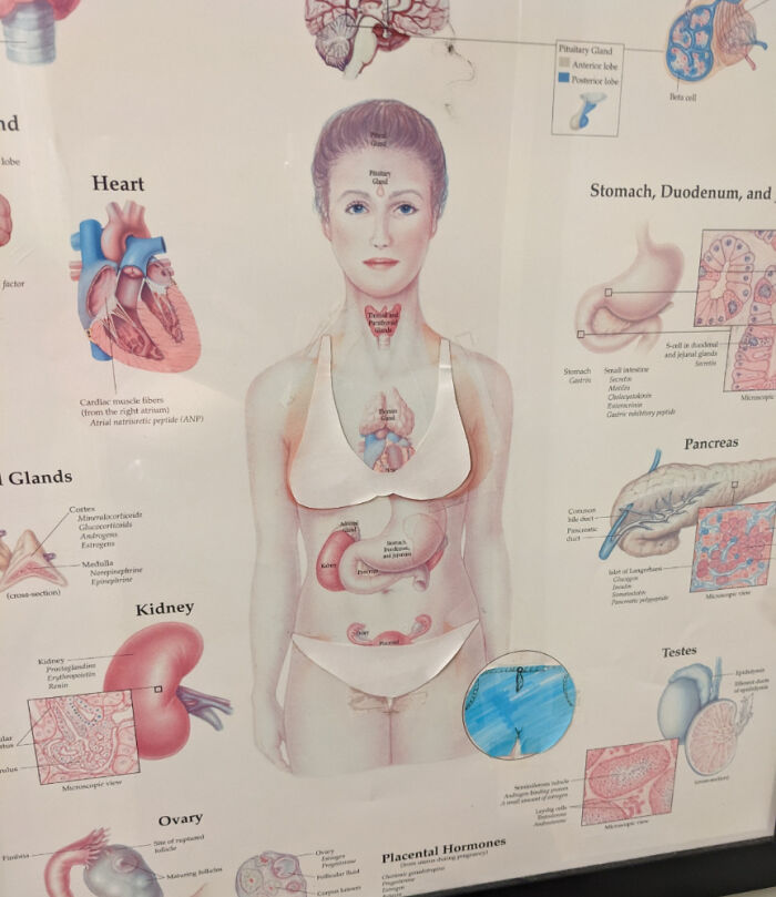 Someone Made A Paper Bikini To Censor A Medical Drawing. Yep.