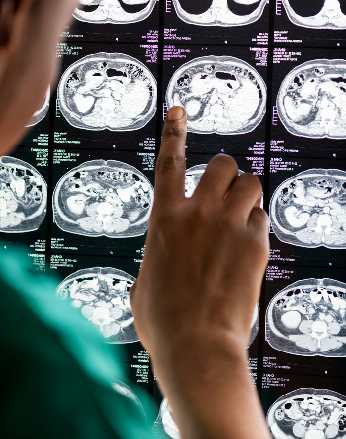 39 Doctors Spill The Weirdest, Wildest Medical Mysteries They've Ever Seen