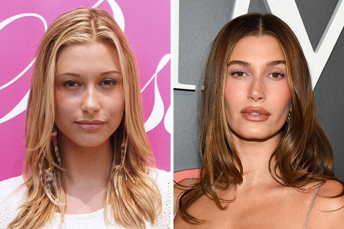 Hailey Bieber’s Not-So-Secret Glow-Up