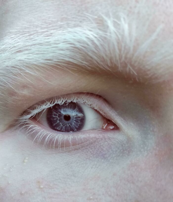 Purple Eyes?! Yep, That's A Thing