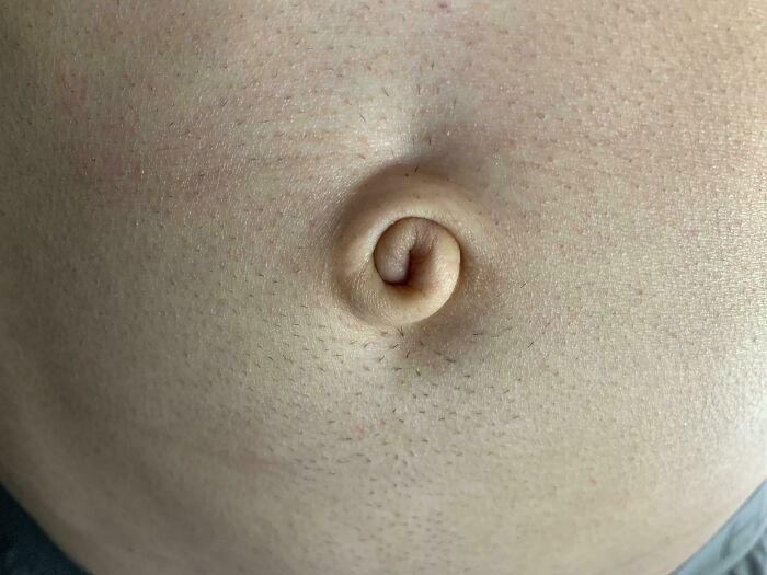 One of the Rarest Belly Buttons? That's Me!