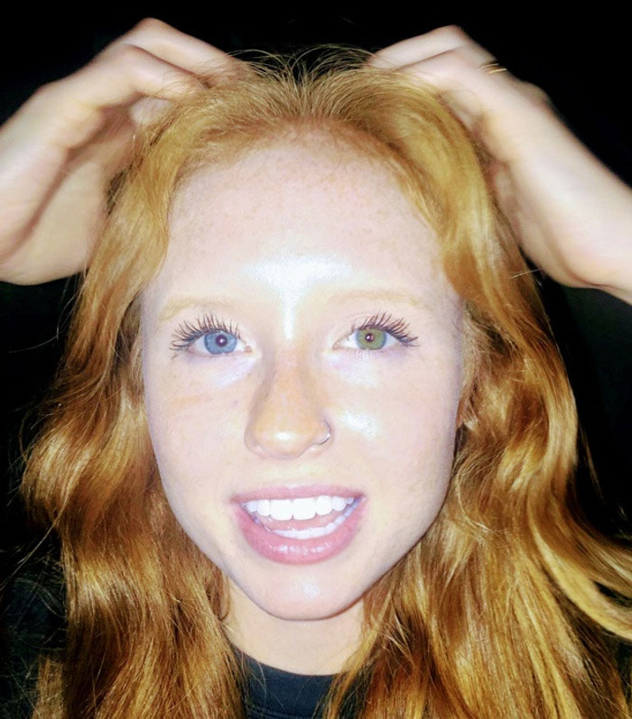 Genetic Masterpiece: Ginger Sister with Two Different Eye Colors!