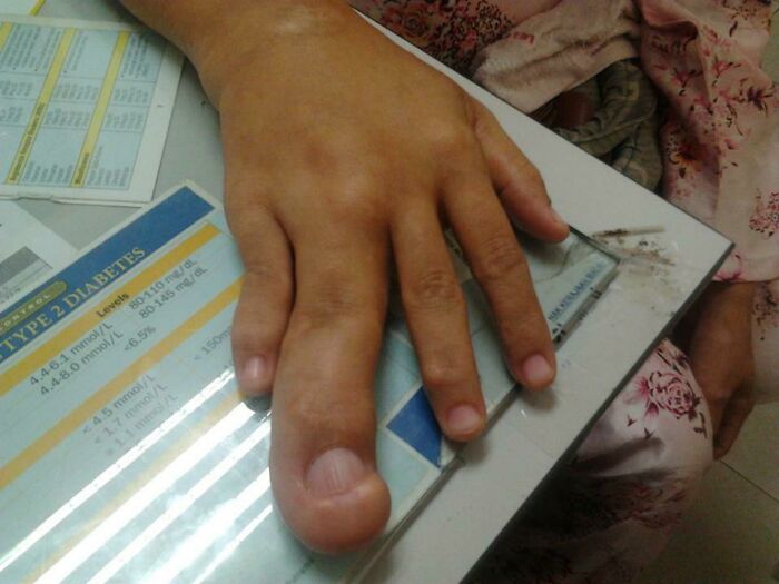 Phew, It’s Not The Middle Finger!