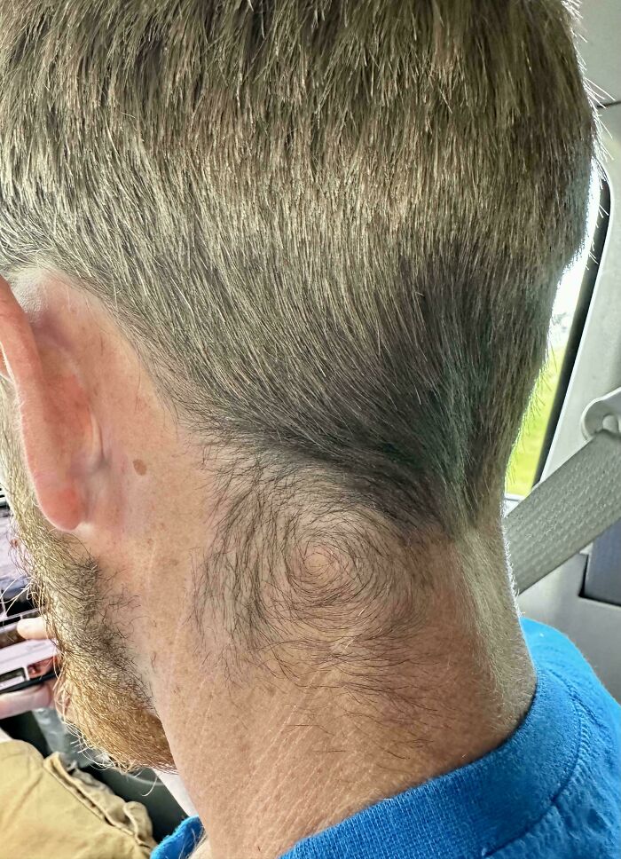 Swirly Neck Hair? My Boyfriend’s Got That Flow