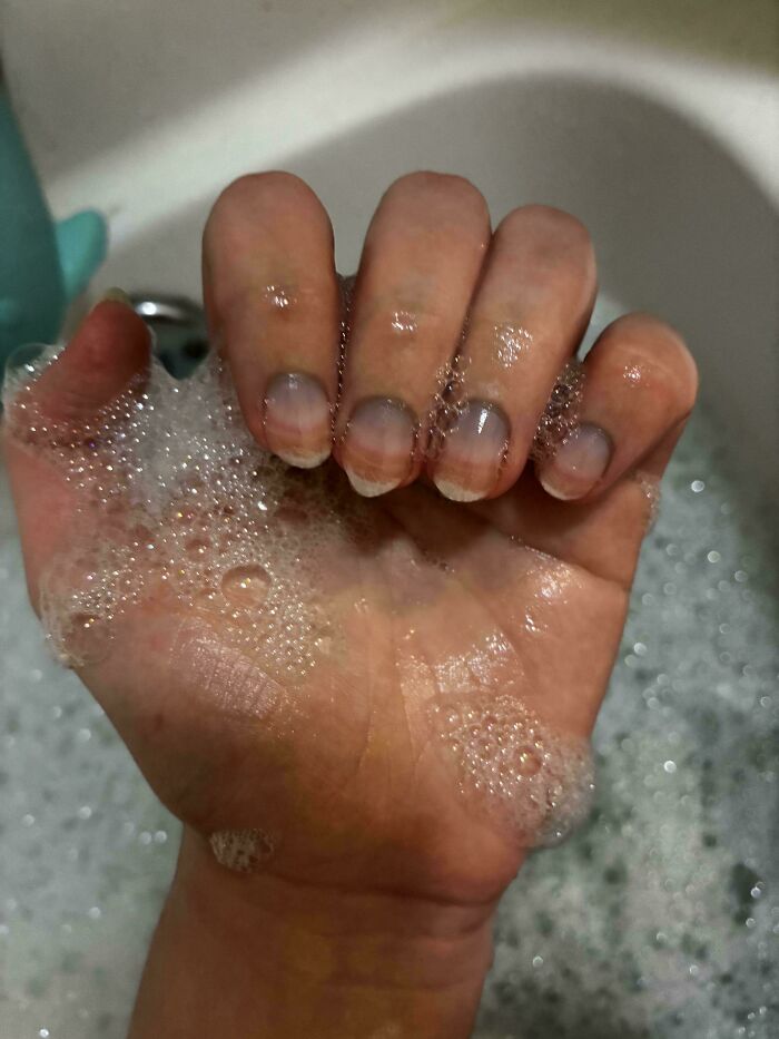 The Wildest Body Stuff People Hide (But Not Anymore!)