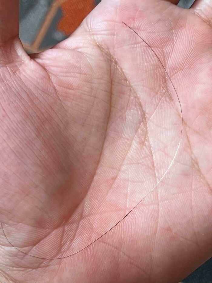 The Wildest Body Stuff People Hide (But Not Anymore!)
