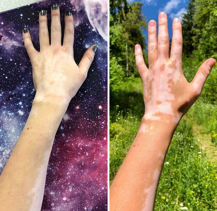 The Wildest Body Stuff People Hide (But Not Anymore!)